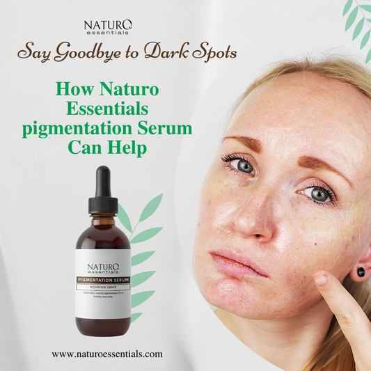 Say Good-Bye to Dark Spots! How Naturo Essential's Pigmentation Serum can help?